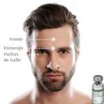 Toxina botulínica (Hombre) - 3 Zonas (Dysport)