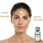 Toxina Botulínica (Mujer) - 3 Zonas (Dysport)