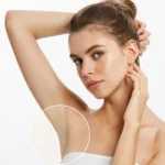 Hiperhidrosis Axilar - Tratamiento