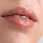 Rehidratación de Labios con Skinbooster
