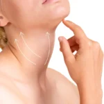 Hilos tensores Pack Soft 20+4 (Cuello)