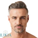 Masculinización Facial - Ácido Hialurónico Ilikia