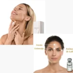 Bioestimulador Lanluma V + Toxina Botulínica