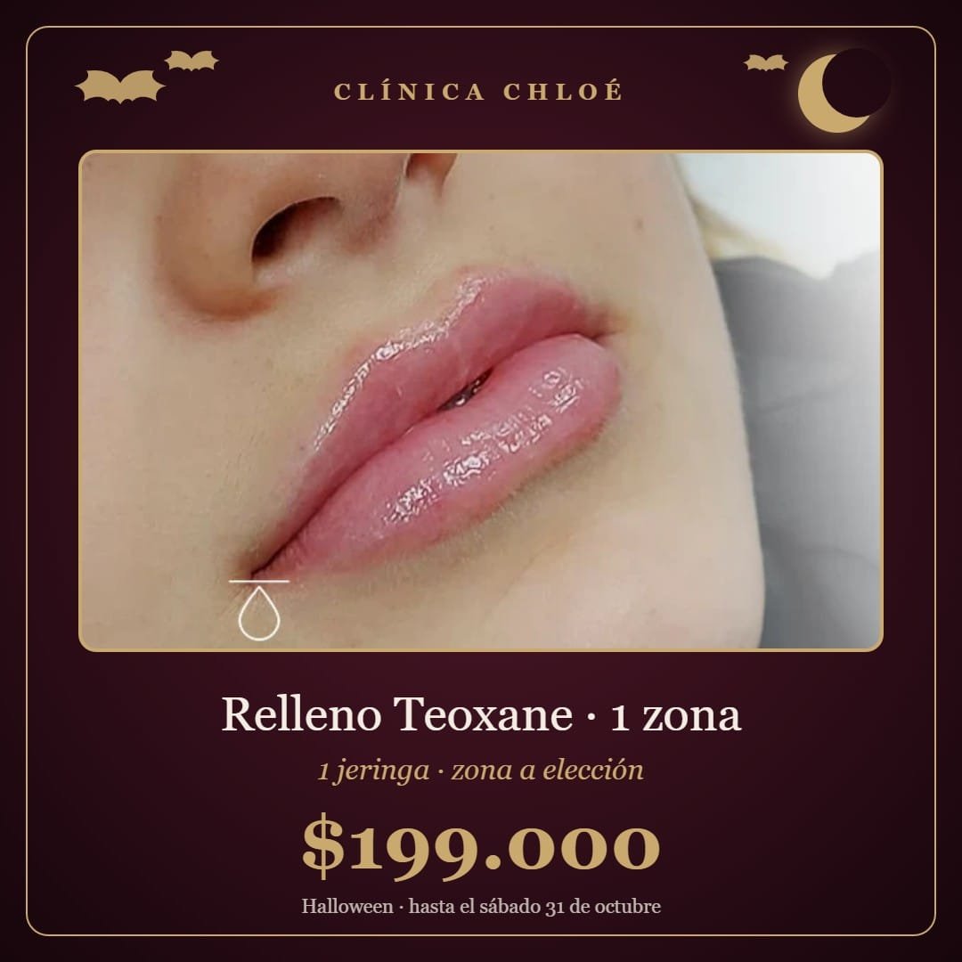 Relleno Teoxane 1 zona (1 jeringa) – Valor especial pacientes